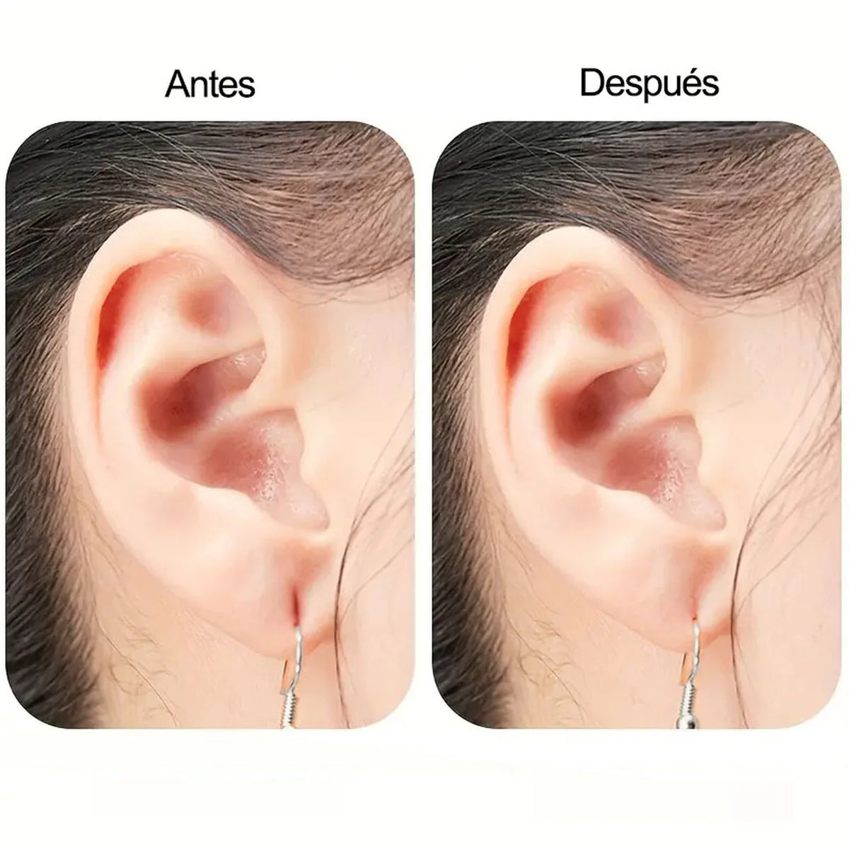 Parches Alzadores de Aros 10 Pares
