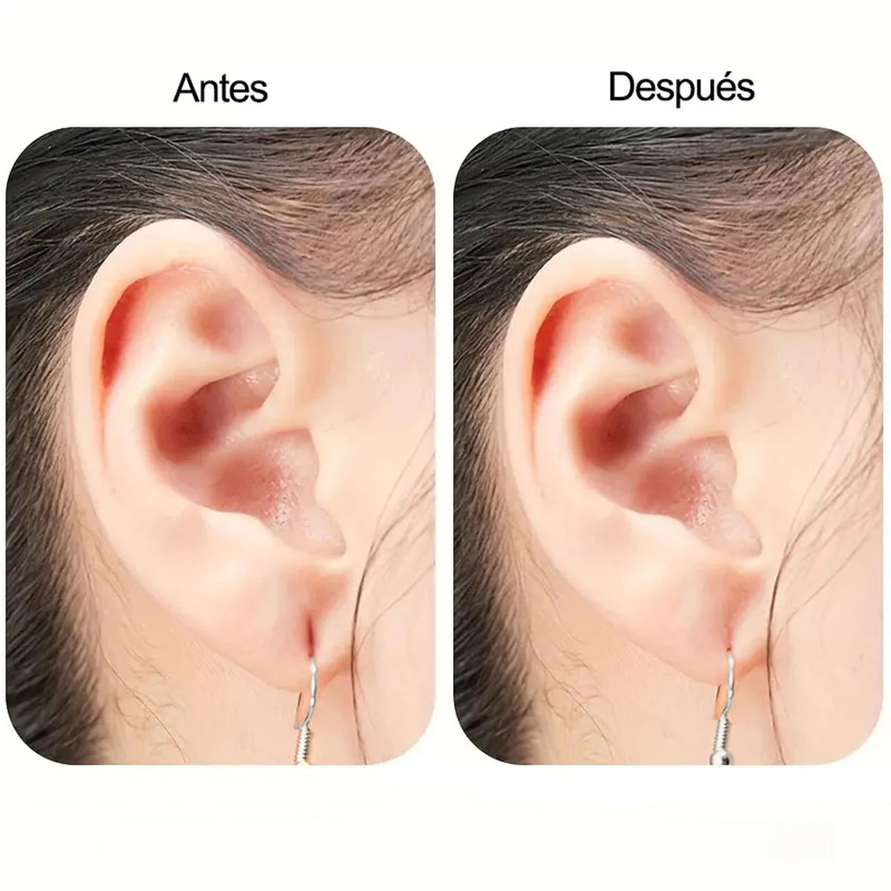 Parches Alzadores de Aros 10 Pares